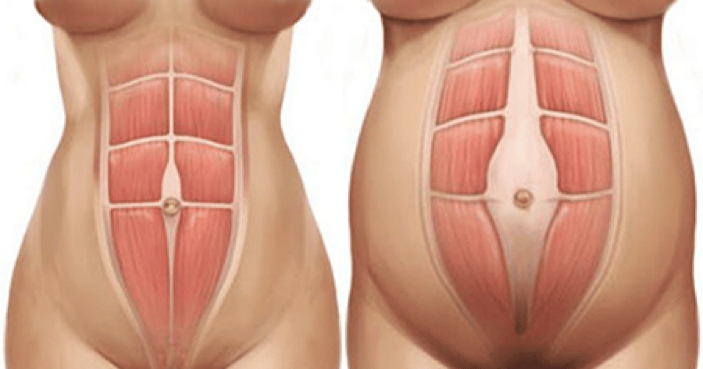 Diastase