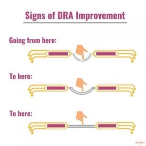 diastase spanning